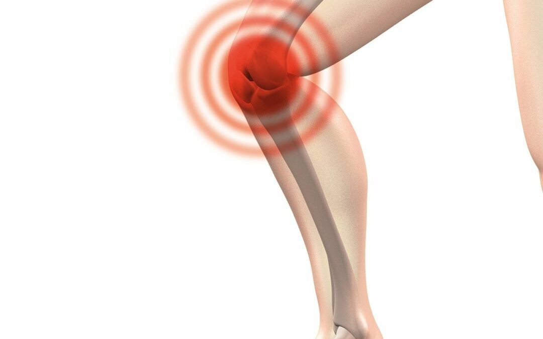 The Importance of Pre-Hab Before Knee Replacement Surgery