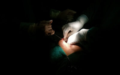 Training After a Coronary Bypass: Why Exercise Matters More Than Ever